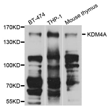 KDM4A / JHDM3A / JMJD2A Antibody