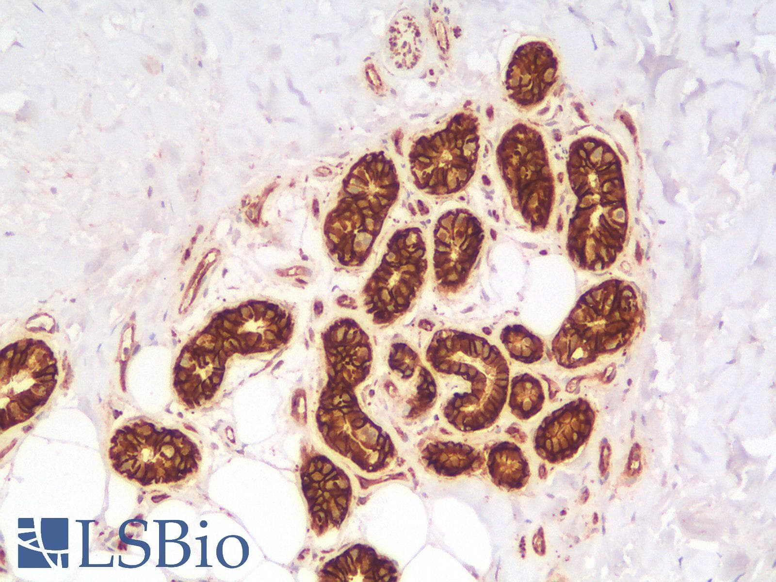 PathPlus™ CTNNB1 / Beta Catenin Antibody (clone rCTNNB1/2173)