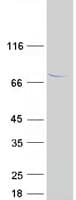 Human TTC30A Protein (Recombinant Myc-DDK (Flag))