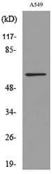 ALDH2 Antibody