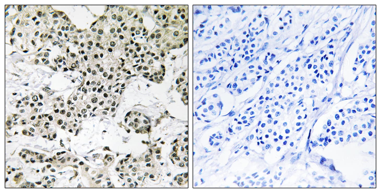 Polyclonal Rabbit anti-Human THOC5 Antibody (aa561-610, IHC)
