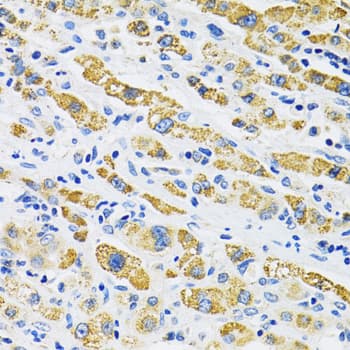 Polyclonal Rabbit anti-Human SLC16A4 Antibody (IHC, IF, WB)