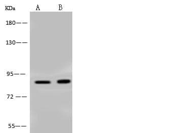 KIAA1811 / BRSK1 Antibody