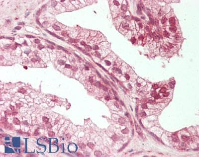 PathPlus™ Polyclonal Rabbit anti-Human BECN1 / Beclin-1 Antibody (N-Terminus, IHC, WB)