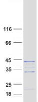 Human RNF41 Protein (Recombinant Myc-DDK (Flag))