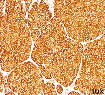 Tyrosinase Antibody (clone T311, Ready-to-Use)