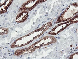 Monoclonal Mouse anti-Human PFKP Antibody (clone OTI3A12, IHC, IF, WB)