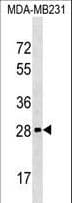H1FOO Antibody (aa138-167)