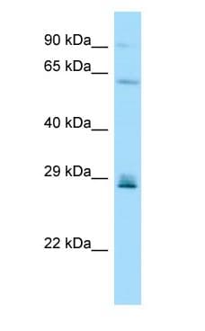 CD99L2 Antibody (aa135-184)