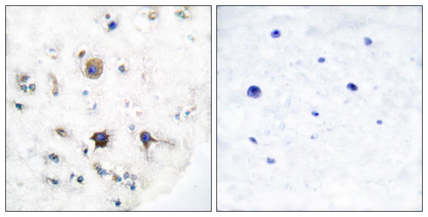 Polyclonal Rabbit anti-Human EFNB3 / Ephrin B3 Antibody (IHC, WB)