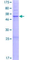 Human TMEM38A Protein (Recombinant GST)