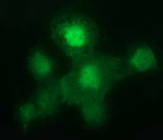 LGALS3 / Galectin 3 Antibody (clone OTI1A4, Carrier-free)