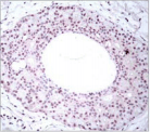 RELA / NFKB p65 Antibody