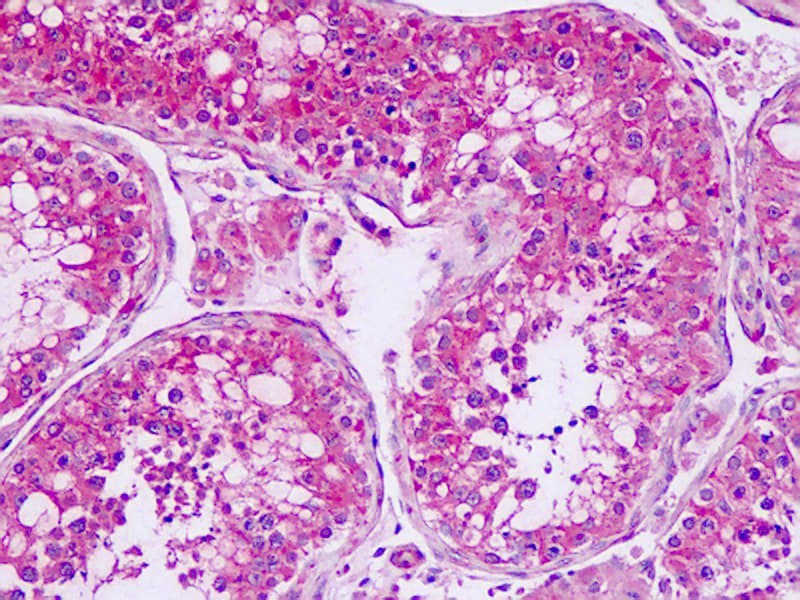 IHC-plus™ Polyclonal Rabbit anti-Human SMO / Smoothened Antibody (1st Extracellular Domain, IHC, IF)