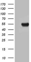 ASL / Argininosuccinate Lyase Antibody (clone OTI3D4)