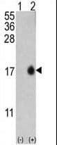 IHC-plus™ MAP1LC3B / LC3B Antibody (Thr6)