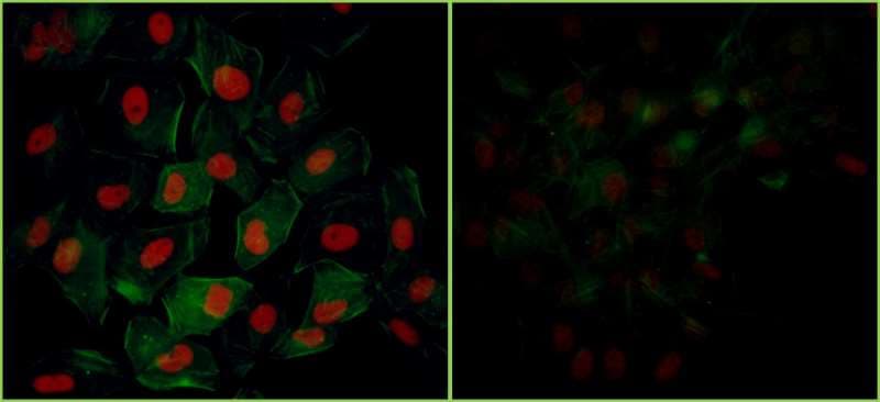 TRIM28 / KAP1 Antibody (phospho-Ser824)