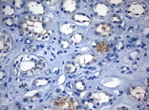 RAB3IP / RABIN3 Antibody (clone OTI5F2)