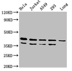 Polyclonal Rabbit anti-Human MAPK1 / ERK2 Antibody (IHC, IF, WB)