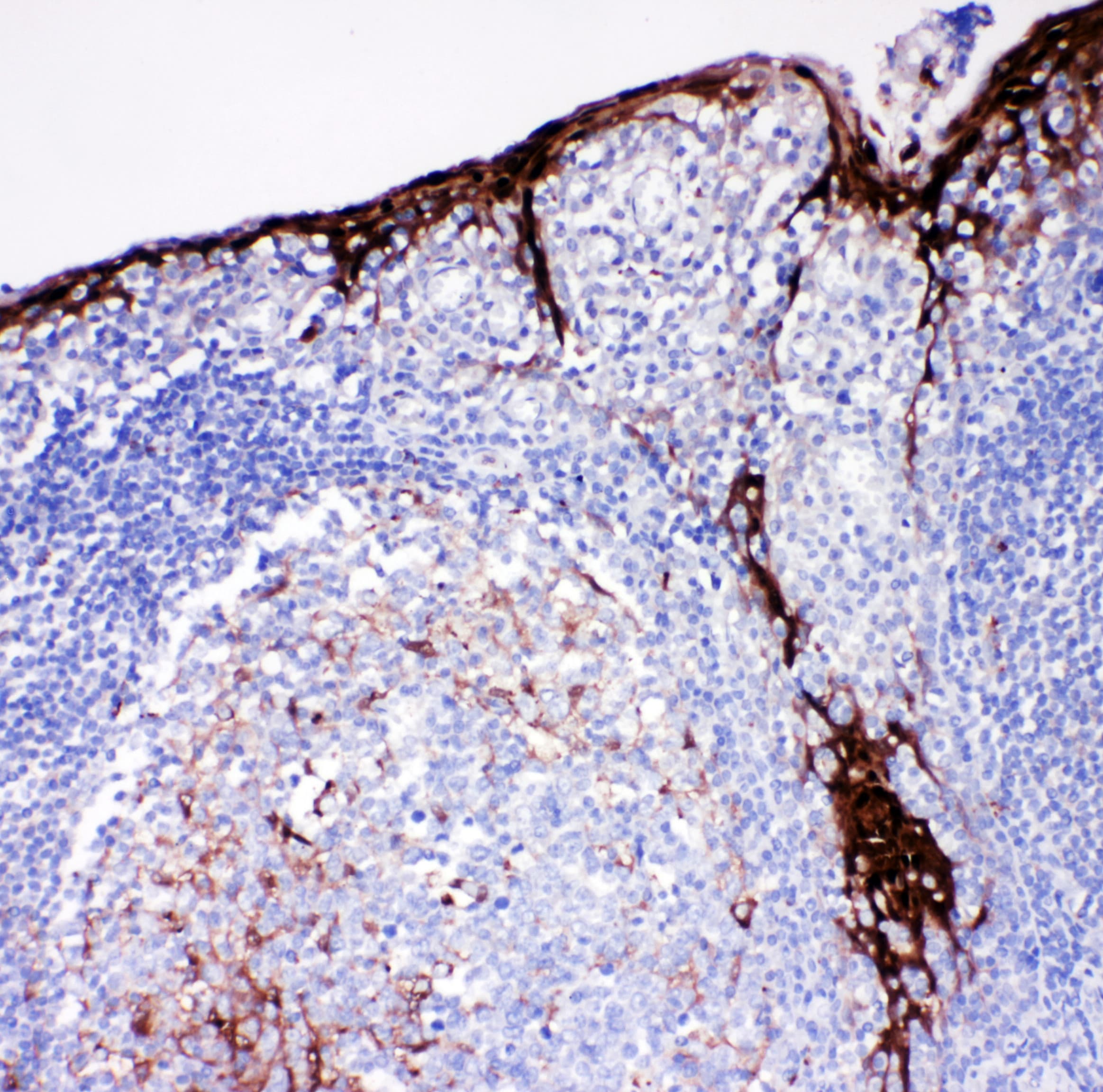 CSTA / Cystatin A Antibody (aa77-90)