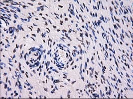 Monoclonal Mouse anti-Human SORD / Sorbitol Dehydrogenase Antibody (clone OTI13G5, IHC, WB)