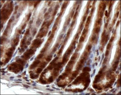RTEL1 Antibody (aa800-1000)