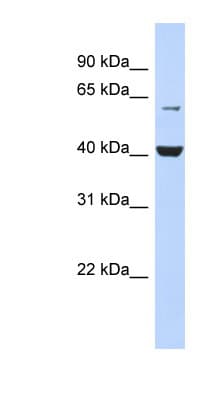 PIGK Antibody (N-Terminus)