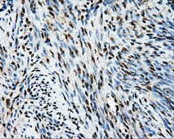 TIPRL / TIP Antibody (clone OTI3D11)