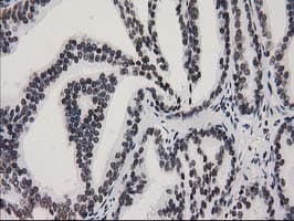 CTDSP1 / SCP1 Antibody (clone OTI1G1)