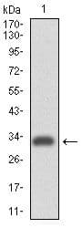 ITGA4 / VLA-4 / CD49d Antibody (clone 5C4)