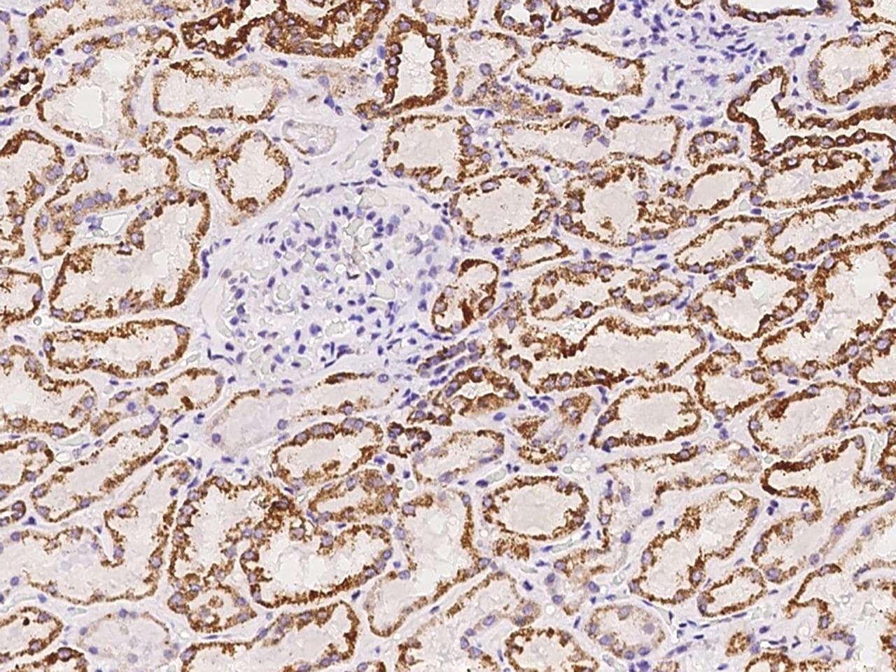 AUH Antibody