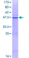 Human DHFRL1 Protein (Recombinant GST)