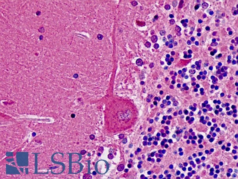 IHC-plus™ Monoclonal Mouse anti-Human PNMT Antibody (clone AT1C11, IHC, WB)
