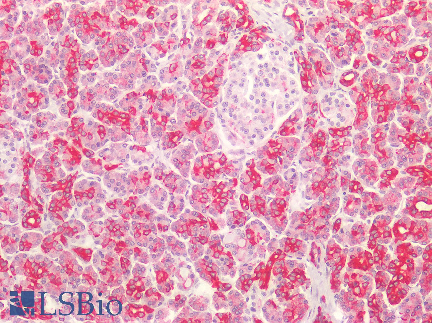 PathPlus™ Monoclonal Mouse anti-Human Basic Cytokeratin AE3 Antibody (clone AE-3, Concentrated, IHC, WB)