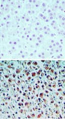 Polyclonal Rabbit anti-Human TNRC5 / CNPY3 Antibody (aa200-250, IHC)