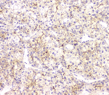 Polyclonal Rabbit anti-Human AKR1D1 Antibody (IHC, WB)