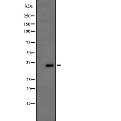 GPR146 Antibody