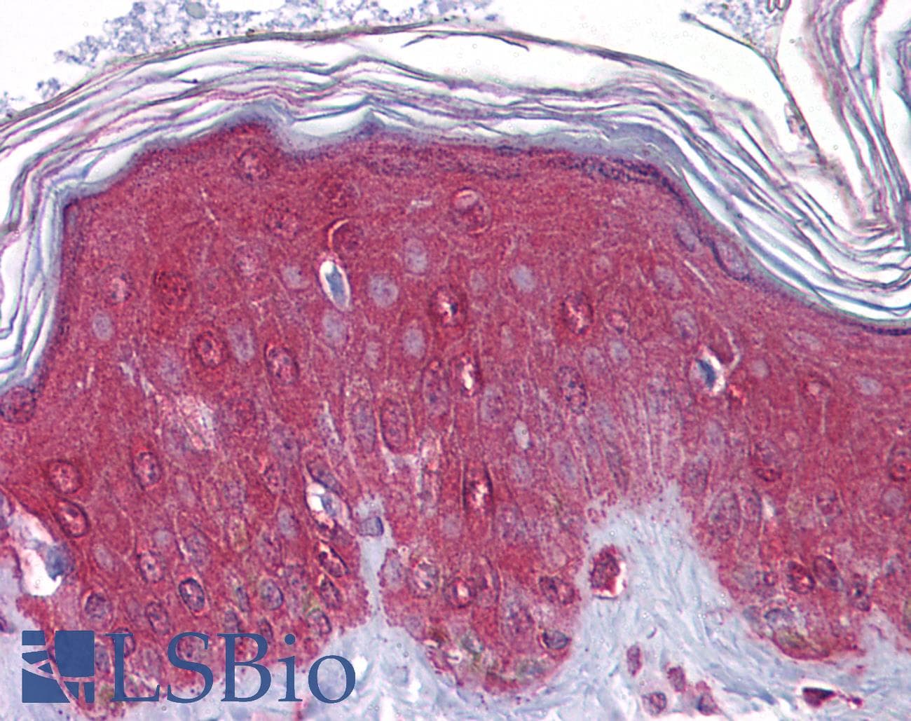 IHC-plus™ FGFR1 / FGF Receptor 1 Antibody (N-Terminus, clone M2F12)