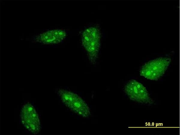 Monoclonal Mouse anti-Human RNF6 Antibody (clone 3B1, IF, WB)