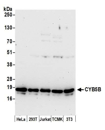 Polyclonal Rabbit anti-Human CYB5B Antibody (aa96-146, WB)