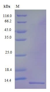 Human VCC-1 / CXCL17 Protein (Recombinant)
