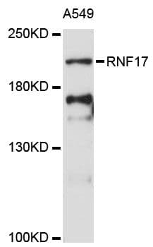 Polyclonal Rabbit anti-Human RNF17 Antibody (WB)