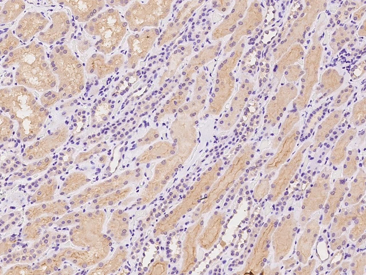 TMEM174 Antibody