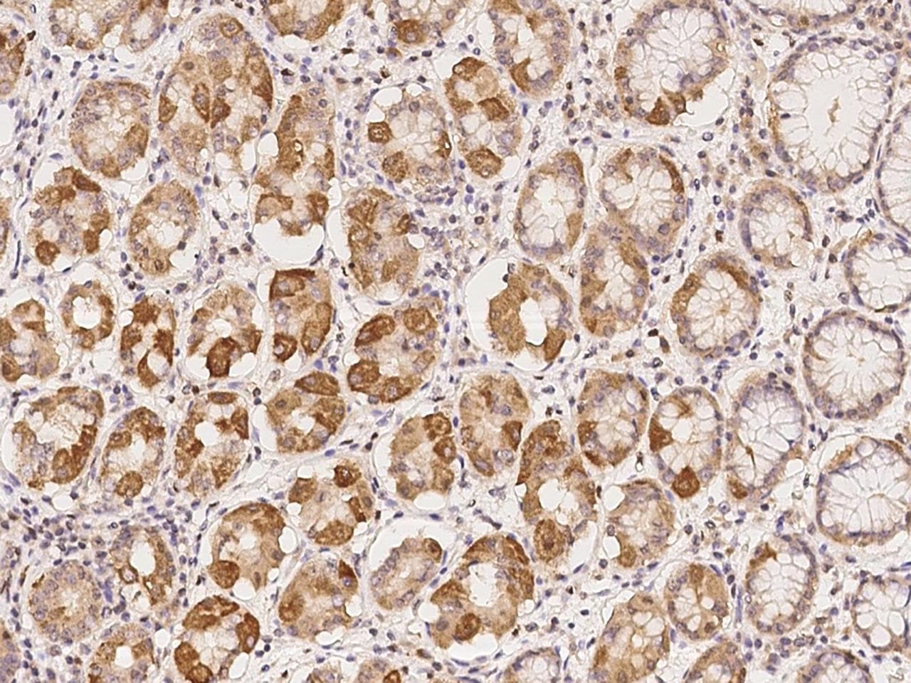 BEND4 Antibody