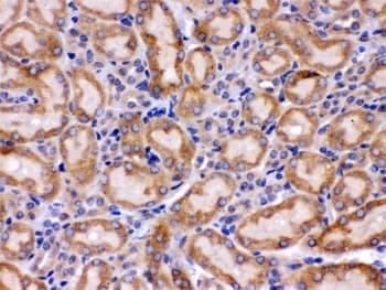 Polyclonal Rabbit anti-Human HSPA9 / Mortalin / GRP75 Antibody (IHC, WB)