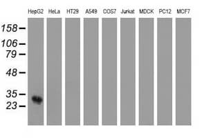 OTUB2 Antibody (clone OTI11A5, Carrier-free)