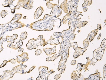 HP / Haptoglobin Antibody