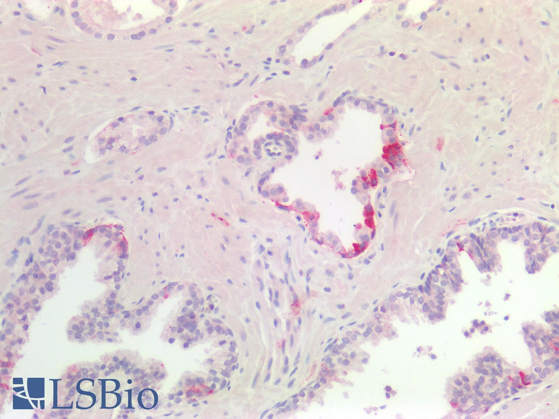 IHC-plus™ CDH3 / P-Cadherin Antibody