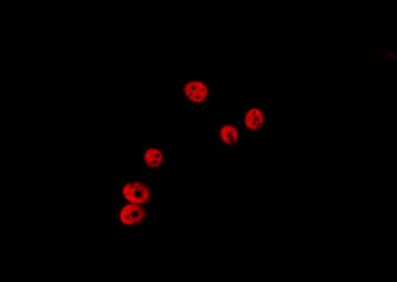 HDAC5 Antibody (phospho-Ser498)