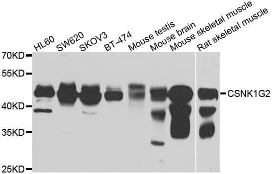 Polyclonal Rabbit anti-Human CSNK1G2 / CKI-Gamma 2 Antibody (IHC, IF, WB)